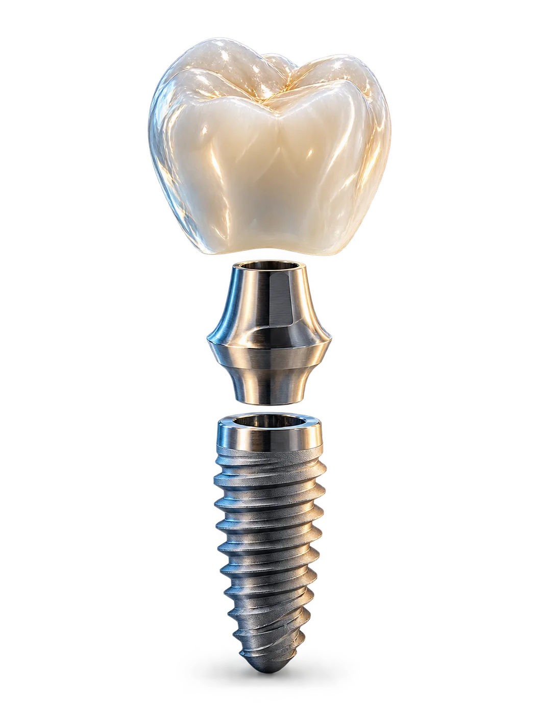 Corona, pilar y tornillo de un implante dental
